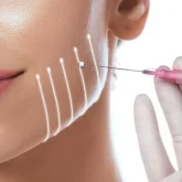 April-Blog-PDO-Thread-Lift-Thread-Smooth-Botox-Fillers-1080x675_480x480